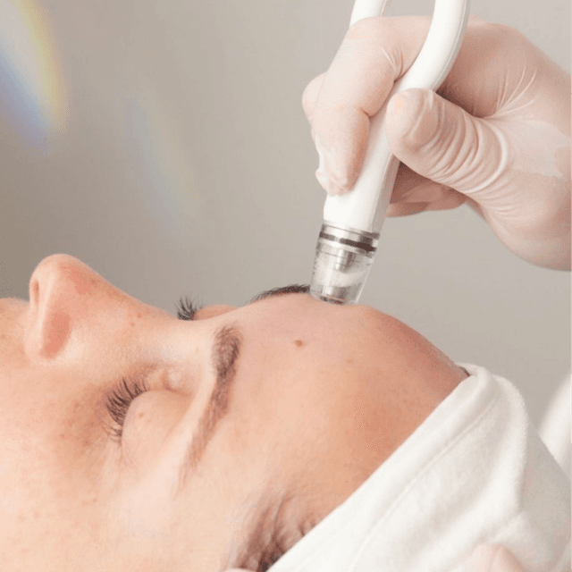 3x DiamondGlow Pkg. at Purely Aesthetic in Phoenix, AZ